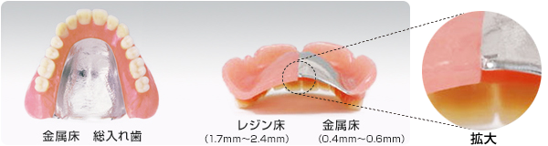 金属床とレジン床の比較